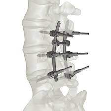 Spine/ Neuro